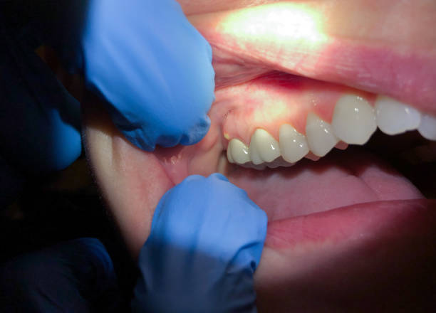 Best Walk-In Dentist Near Me  in Washington Park, IL