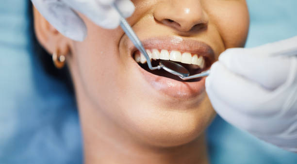 Best Dentist for Severe Toothache  in Washington Park, IL